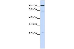 WB Suggested Anti-CDC45L Antibody Titration:  0. (CDC45 Antikörper  (C-Term))