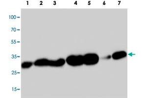 Western blot analysis of tissue extracts with PDPN polyclonal antibody . (Podoplanin Antikörper  (C-Term))