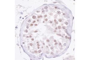 Immunohistochemistry (IHC) image for anti-Nuclear Receptor Coactivator 2 (NCOA2) (C-Term) antibody (ABIN7454615)