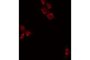 ABIN6277029 staining HuvEC by IF/ICC. (CD70 Antikörper  (Internal Region))
