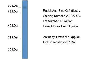 Western Blotting (WB) image for anti-SMEK Homolog 2, Suppressor of Mek1 (Dictyostelium) (SMEK2) (C-Term) antibody (ABIN785891) (SMEK2 Antikörper  (C-Term))