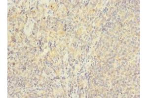 Immunohistochemistry (IHC) image for anti-Hydrogen Voltage-Gated Channel 1 (HVCN1) (AA 1-100) antibody (ABIN7175617)