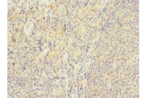 Immunohistochemistry of paraffin-embedded human tonsil tissue using ABIN7175617 at dilution of 1:100 (HVCN1 Antikörper  (AA 1-100))