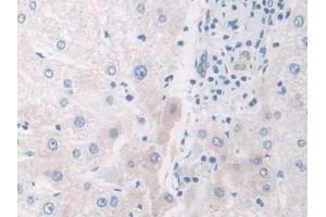 IHC-P analysis of Human Liver Tissue, with DAB staining. (IL12A Antikörper  (AA 23-219))