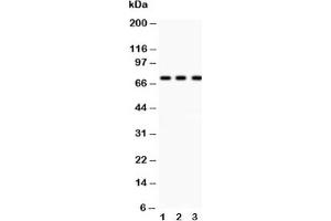 Western blot testing of p73 antibody and Lane 1:  COLO320;  2: MCF-7;  3: HeLa lysate (Tumor Protein p73 Antikörper  (AA 1-198))