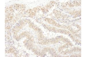 Immunohistochemistry (IHC) image for anti-Proteasome (Prosome, Macropain) 26S Subunit, ATPase, 4 (PSMC4) (AA 368-418) antibody (ABIN7454974)