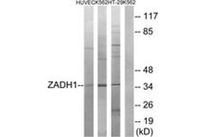Western blot analysis of extracts from K562/HuvEc/HT-29 cells, using ZADH1 Antibody. (PTGR2 Antikörper  (AA 181-230))