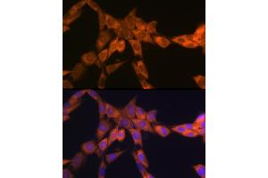 Immunofluorescence analysis of NIH-3T3 cells using 67 kDa Laminin Receptor Rabbit mAb (ABIN7270042) at dilution of 1:100 (40x lens). (RPSA/Laminin Receptor Antikörper)