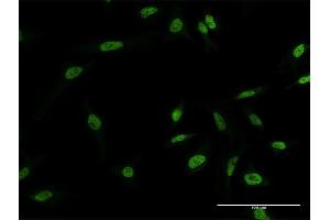 Immunofluorescence of monoclonal antibody to MYNN on HeLa cell. (Myoneurin Antikörper  (AA 501-610))