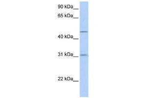 SLC39A11 antibody used at 1 ug/ml to detect target protein. (SLC39A11 Antikörper)