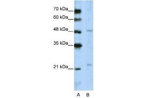 WDR12 antibody used at 5 ug/ml to detect target protein. (WDR12 Antikörper  (C-Term))