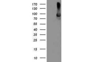 HEK293T cells were transfected with the pCMV6-ENTRY control (Left lane) or pCMV6-ENTRY ALOX15 (Right lane) cDNA for 48 hrs and lysed. (ALOX15 Antikörper)