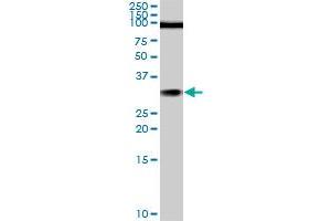 TGIF2 monoclonal antibody (M02), clone 5B11. (TGIF2 Antikörper  (AA 131-236))