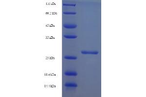 SDS-PAGE (SDS) image for Vpx Protein (VPX) (AA 1-112), (full length) protein (His-SUMO Tag) (ABIN5710812)