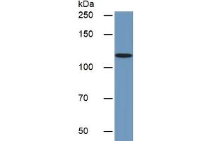 Rabbit Detection antibody from the kit in WB with Positive Control:  Sample Human Jurkat lysate.