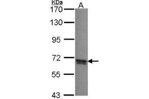 Western Blot analysis: PPP2R5B antibody staining of A431 whole cell lysate (30 µg) at 1/1000 dilution, 7.