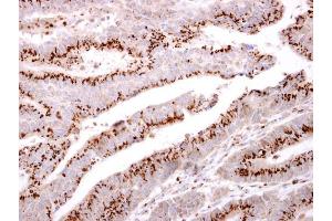 Immunohistochemistry (IHC) image for anti-Golgi Membrane Protein 1 (GOLM1) (C-Term) antibody (ABIN2856522)