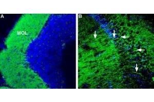 Immunohistochemistry (IHC) image for anti-Corticotropin Releasing Hormone Receptor 1 (CRHR1) (AA 31-44), (Extracellular) antibody (ABIN7043086)