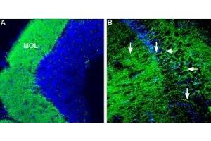 Expression of Corticotropin-releasing factor receptor 1 in mouse brain - Immunohistochemical staining of mouse hippocampus and mouse cerebellum using Anti-CRF1/CRHR1 (extracellular) Antibody (ABIN7043086, ABIN7044185 and ABIN7044186), (1:600). (CRHR1 Antikörper  (Extracellular, N-Term))