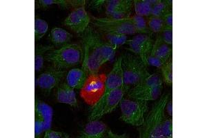 Immunofluorescence staining of methanol-fixed Hela using NFkB-p65(Phospho-Thr254) Antibody. (NF-kB p65 Antikörper  (pThr254))