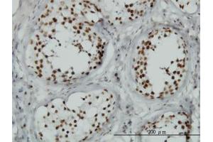 Image no. 1 for anti-Tousled-Like Kinase 1 (TLK1) (AA 111-230) antibody (ABIN599099) (TLK1 Antikörper  (AA 111-230))