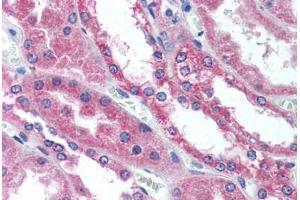 Immunohistochemistry (IHC) image for anti-Wingless-Type MMTV Integration Site Family, Member 1 (WNT1) (Internal Region) antibody (ABIN1049465)