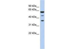 Image no. 1 for anti-RD RNA Binding Protein (RDBP) (AA 35-84) antibody (ABIN6742975) (RDBP Antikörper  (AA 35-84))