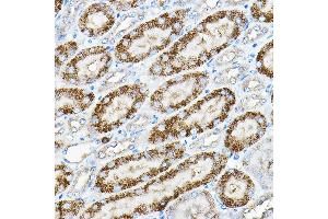 Immunohistochemistry of paraffin-embedded mouse kidney using Alkaline Phosphatase (Alkaline Phosphatase (ALPL)) Rabbit pAb (ABIN6133557, ABIN6136824, ABIN6136825 and ABIN6216013) at dilution of 1:200 (40x lens). (ALPL Antikörper  (AA 150-250))