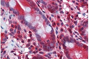 Human Small Intestine: Formalin-Fixed, Paraffin-Embedded (FFPE) (STIP1 Antikörper  (AA 445-544))