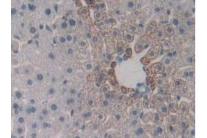 Immunohistochemistry (IHC) image for anti-Endoglin (ENG) (AA 27-137) antibody (ABIN7432973)