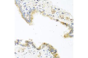 Immunohistochemistry of paraffin-embedded mouse lung using RETN antibody (ABIN5974977) at dilution of 1/100 (40x lens).