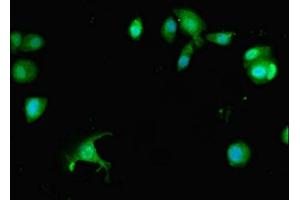 Immunofluorescent analysis of MCF-7 cells using ABIN7163177 at dilution of 1:100 and Alexa Fluor 488-congugated AffiniPure Goat Anti-Rabbit IgG(H+L) (PREX1 Antikörper  (AA 1-44))