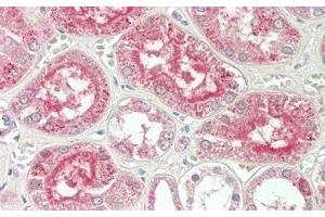 Detection of ALT in Human Kidney Tissue using Polyclonal Antibody to Alanine Aminotransferase (ALT) (ALT Antikörper  (AA 147-263))