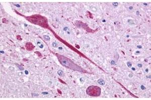Immunohistochemical (Formalin/PFA-fixed paraffin-embedded sections) staining in human brain, neurons and glia with P2RY14 polyclonal antibody . (P2RY14 Antikörper  (C-Term))