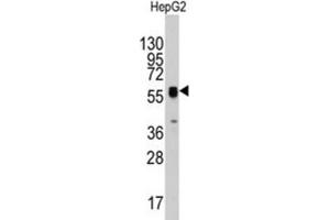 Western Blotting (WB) image for anti-Thymidine Phosphorylase (TYMP) antibody (ABIN3003120) (Thymidine Phosphorylase Antikörper)