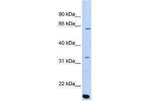 ARID5A antibody used at 0.