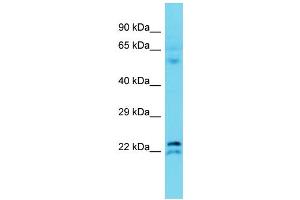 Host: Rabbit Target Name: TMEM182 Sample Type: Fetal Liver lysates Antibody Dilution: 1. (TMEM182 Antikörper  (N-Term))