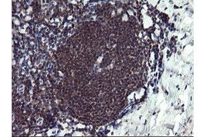 Image no. 3 for anti-Peptidylprolyl Isomerase (Cyclophilin)-Like 3 (PPIL3) antibody (ABIN1500364) (PPIL3 Antikörper)