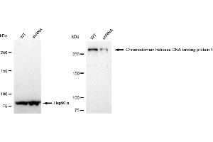 Western blotting analysis using Chromodomain helicase DNA binding protein 4 antibody (ABIN7800918). (Rekombinanter Chromodomain Helicase DNA Binding 4 Antikörper)