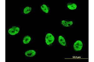 Immunofluorescence of monoclonal antibody to HES2 on HeLa cell. (HES2 Antikörper  (AA 41-114))