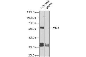 Western blot analysis of extracts of various cell lines, using MICB antibody (ABIN6133301, ABIN6143831, ABIN6143832 and ABIN6225101) at 1:1000 dilution. (MICB Antikörper  (AA 23-108))