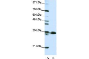 Western Blotting (WB) image for anti-Heterogeneous Nuclear Ribonucleoprotein A1 (HNRNPA1) antibody (ABIN2462116) (HNRNPA1 Antikörper)