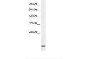 Image no. 2 for anti-Homeobox A1 (HOXA1) (C-Term) antibody (ABIN202024) (HOXA1 Antikörper  (C-Term))