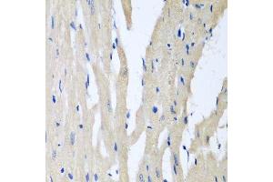 Immunohistochemistry of paraffin-embedded rat heart using PITRM1 antibody. (PITRM1 Antikörper  (AA 758-1037))