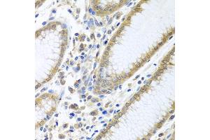 Immunohistochemistry of paraffin-embedded human stomach using EIF4E antibody (ABIN5971189) at dilution of 1/100 (40x lens). (EIF4E Antikörper)