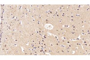 Detection of BDNF in Porcine Cerebrum Tissue using Polyclonal Antibody to Brain Derived Neurotrophic Factor (BDNF) (BDNF Antikörper  (AA 20-252))