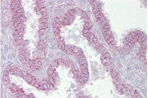 Immunohistochemistry with Uterus tissue at an antibody concentration of 5µg/ml using anti-CDK9 antibody (AVARP03004_P050) (CDK9 Antikörper  (N-Term))