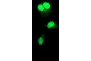 Anti-RAD51L1 mouse monoclonal antibody (ABIN2455028) immunofluorescent staining of COS7 cells transiently transfected by pCMV6-ENTRY RAD51L1 (RC206457). (RAD51 Homolog B Antikörper  (AA 119-346))