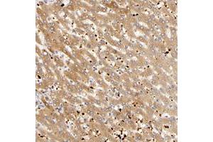 Immunohistochemical staining of human liver with AGT polyclonal antibody  shows moderate cytoplasmic positivity in hepatocytes. (AGT Antikörper)
