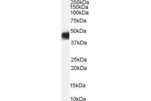 Western Blotting (WB) image for Cerebral Cavernous Malformation 2 (CCM2) peptide (ABIN369275) (Cerebral Cavernous Malformation 2 (CCM2) Peptid)